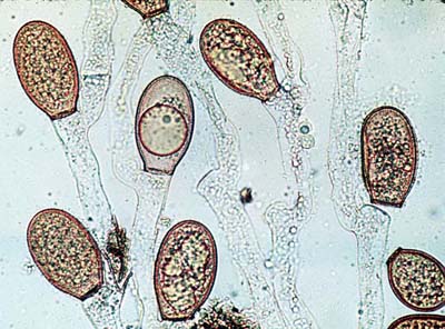 Zygosporas